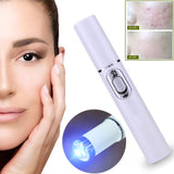 Laser Pen Portable Wrinkle Removal Machine - Emete Store