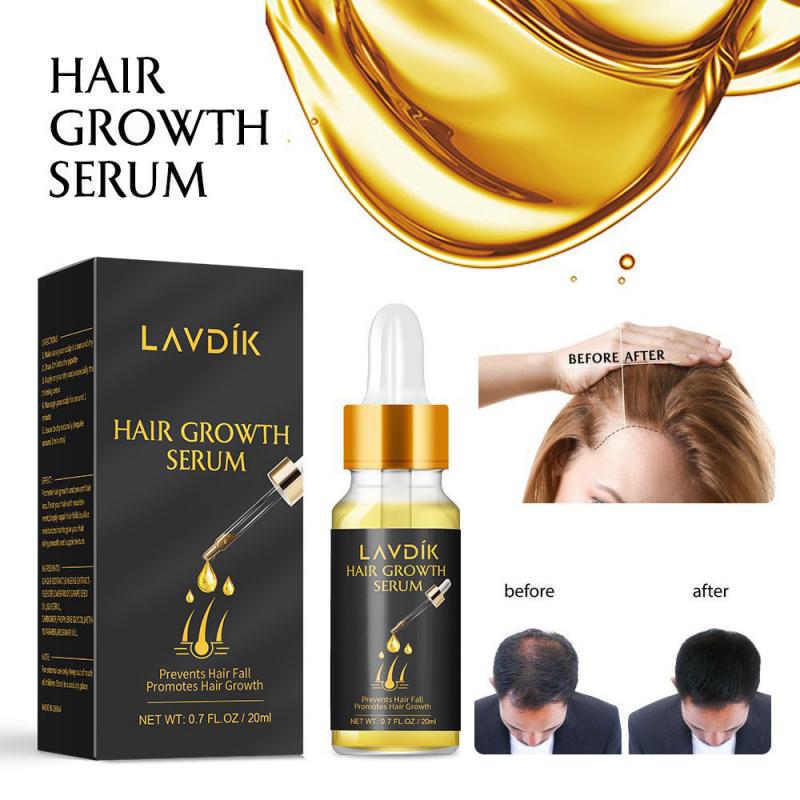 Hair Growth Serum Essential Oil Anti Preventing Hair Lose Ginger Fast - Emete Store